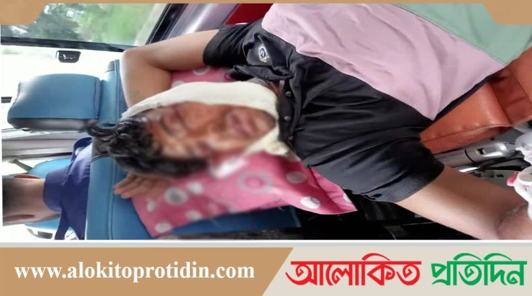 কারাগারে ঘুমের ভেতর হাজতির ২ চোখ নষ্ট করে দিল কয়েদী 