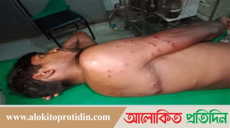কুড়িগ্রাম সীমান্তে বিএসএফের রাবার বুলেটে বাংলাদেশী যুবক আহত