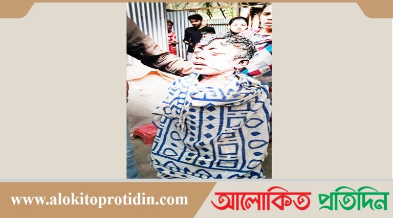 সন্তানের গায়ে পেট্রোল ঢেলে হত্যা চেষ্টার অভিযোগ