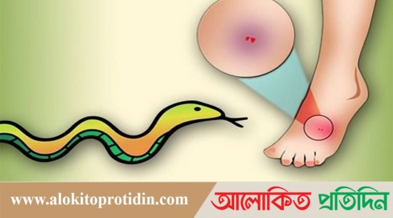 বোরহানউদ্দিনে সাপের কামড়ে বৃদ্ধের মৃত্যু