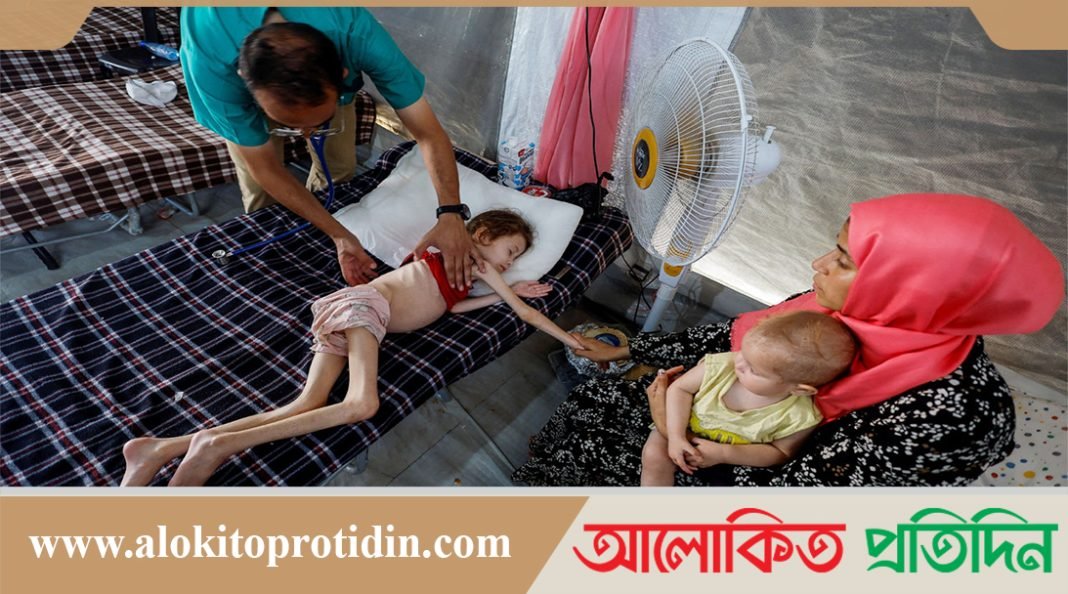 গাজায় ছড়িয়ে পড়া দুর্ভিক্ষে অন্তত ৩৩ শিশুর মৃত্যু : জাতিসংঘ