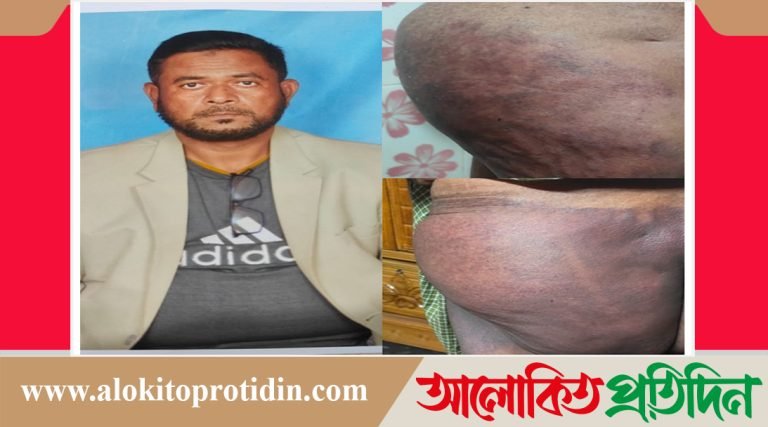 সেনা সদস্য পরিবারের নির্যাতনের স্বীকার, কামাল উদ্দিন ও আব্দুল আলিম!