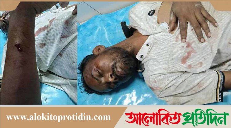 হিরো আলমের অবস্থা ‘আশঙ্কাজনক’, বদলাতে হয়েছে হাসপাতাল