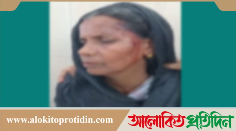 গাজীপুরে গাছায় মারধরের অভিযোগে মামলা না নিয়ে জিডি এন্ট্রি