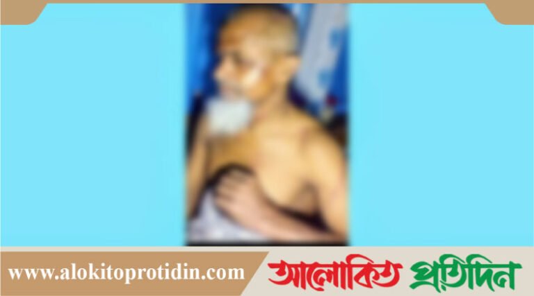 চন্দ্রগঞ্জের ইসমাইলকে কু*পিয়ে জ*খম থানায় অ*ভিযোগ দিয়েও কোন ব্যবস্থা নেয়নি পুলিশ