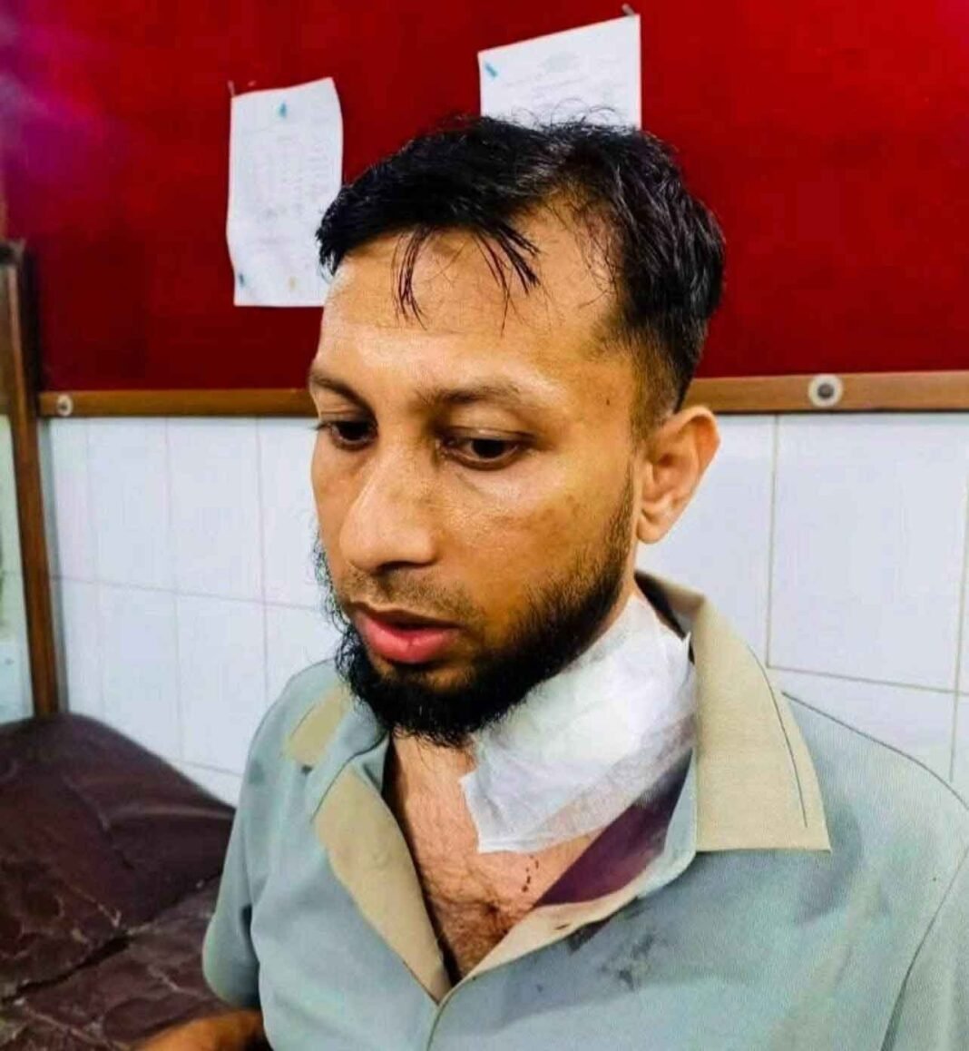 বাড়ি যাওয়ার পথে ডা*কাতদের হা*মলায় আ*হত মুরাদনগরের এ*সিল্যান্ড